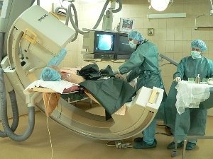 Ангиопластика и стентирование коронарных артерий и сосудов