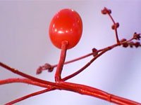 Ангиография сосудов головного мозга