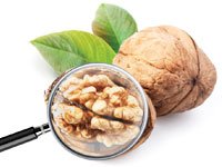 МРТ ангиография сосудов головного мозга