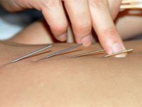 Лечение ДЦП за границей