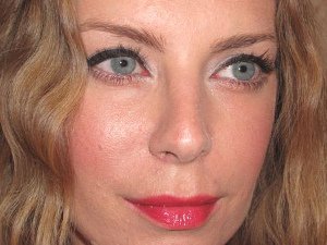 Отзыв о контурной пластике носогубных складок