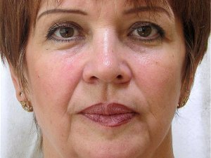 Отзывы о биорепарации