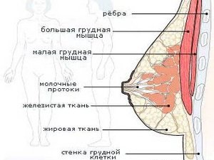Схема женской груди для проведения операции