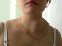 Отзывы лечившихся от лимфомы Ходжкина