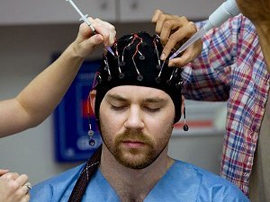 Неплохие отзывы о лечении эпилепсии в Германии