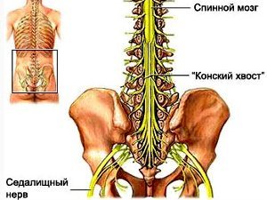 Что представляет собой синдром конского хвоста