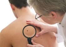 Современные хирургические и безоперационные методы лечения новообразований на коже