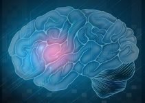 Хирургическое лечение опухолей головного мозга в израильских клиниках – эффективно и безопасно