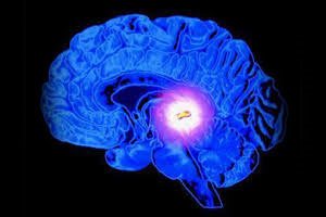 Киста головного мозга: лечение согласно международным стандартам