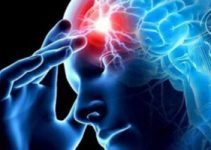 Лечение менингиомы в Израиле – это ультраточная диагностика и инновационные хирургические и консервативные методы терапии опухолей головного мозга