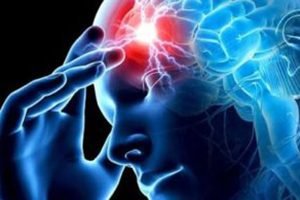 Лечение менингиомы в Израиле – это ультраточная диагностика и инновационные хирургические и консервативные методы терапии опухолей головного мозга