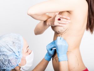 Показания и противопоказания к подтяжке груди