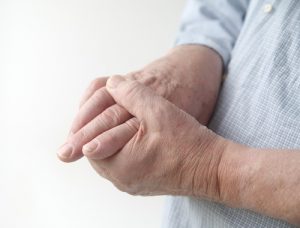 Ревматоидный артрит лечение в венгрии