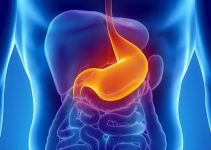 шунтирование желудка