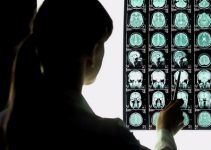 Лечение аневризмы в Германии