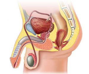 Операция при раке простаты в Израиле – ваш шанс победить болезнь