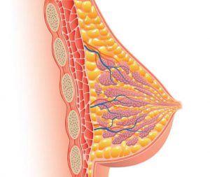 Операция при раке молочной железы в Израиле