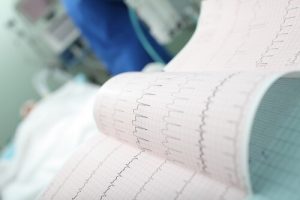 Лечение стенокардии за границей