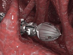 Простатэктомия в Германии: возможность не только победить рак, но и сохранить потенцию
