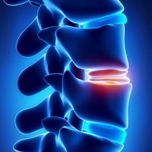 О заболевании