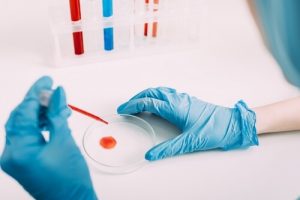 Обследование и диагностика простатита в Германии