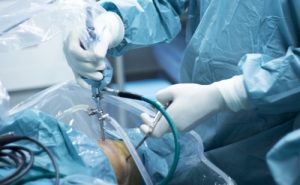 Методы лечения саркомы в Израиле 