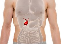 Удаление камней желчного пузыря в Германии