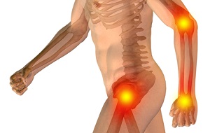 Разрыв сухожилия