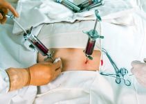 Пересадка костного мозга в Турции