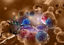 Лечение лейкоплакии в Израиле