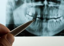 Амелобластома