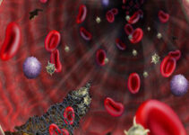 гемобластоз